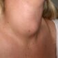 Struma_001 1024x765 1 85x85